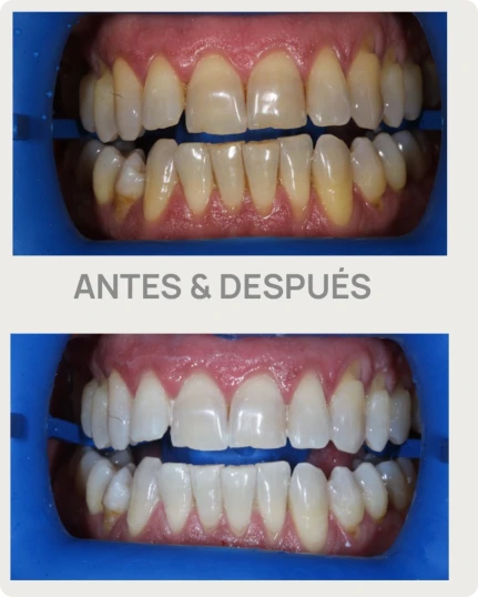 armonia 1208 f1