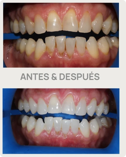 armonia 1208 f2